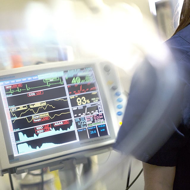 Un primo piano di un monitor medico.