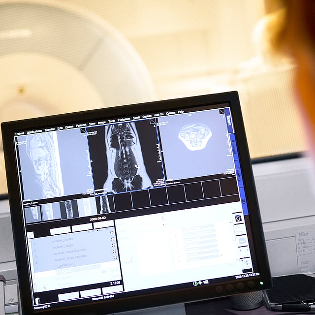 Lo schermo di un computer con immagini radiografiche.