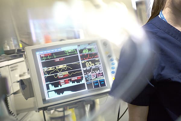 Un primo piano di un monitor medico.