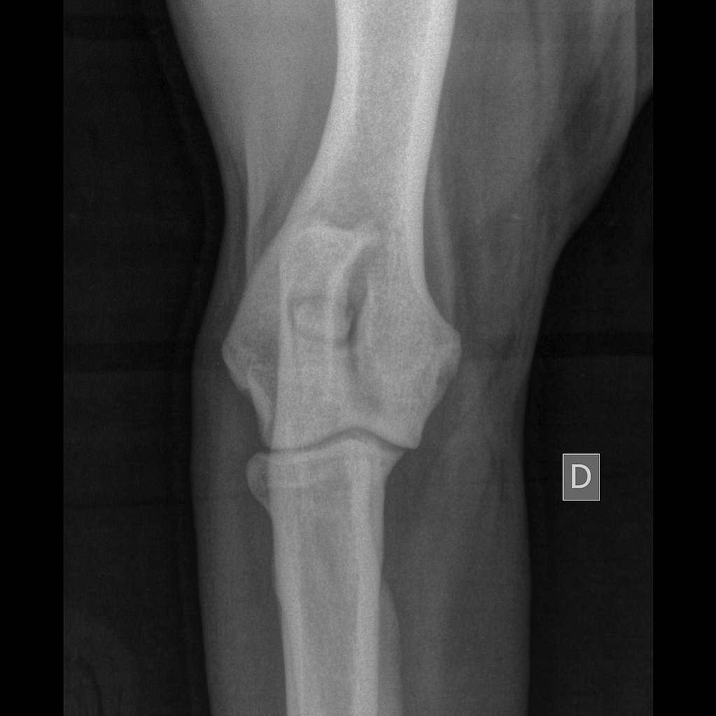 Radiografia di una gamba con un osso.