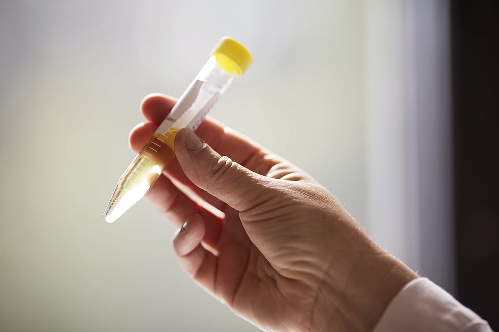 Una mano che tiene un tubo con un tappo giallo.