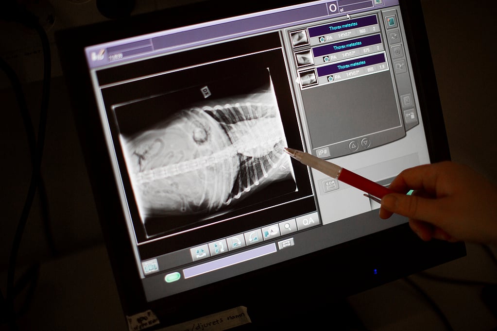 Una mano che tiene una penna che indica una radiografia.