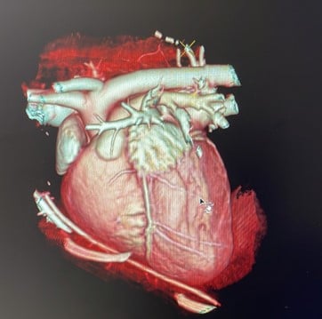 Un primo piano di un cuore.