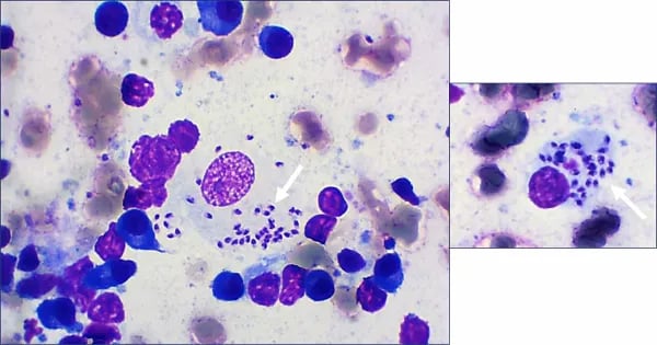 Un primo piano di un microscopio.