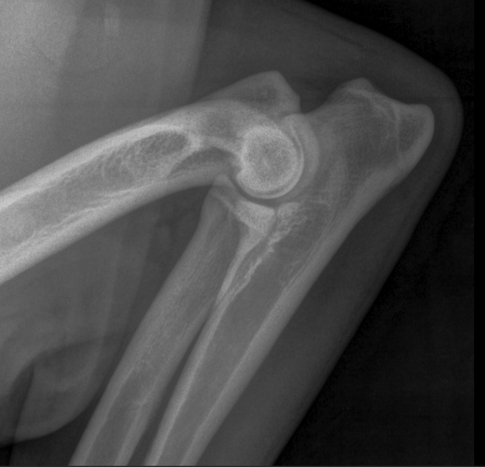 Radiografia di un'articolazione della spalla.