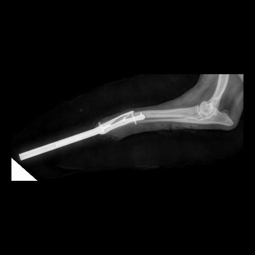 Radiografia di un osso con una vite attaccata ad esso.