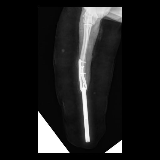 Radiografia di un osso con un'asta di metallo.
