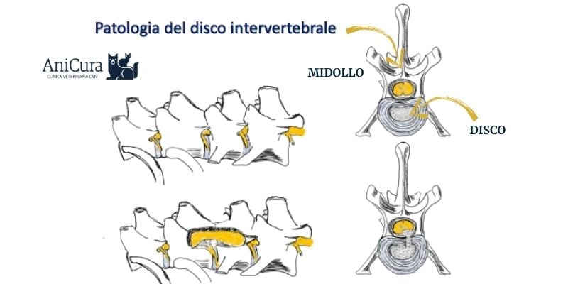 Diagramma di una colonna vertebrale di Huperson.